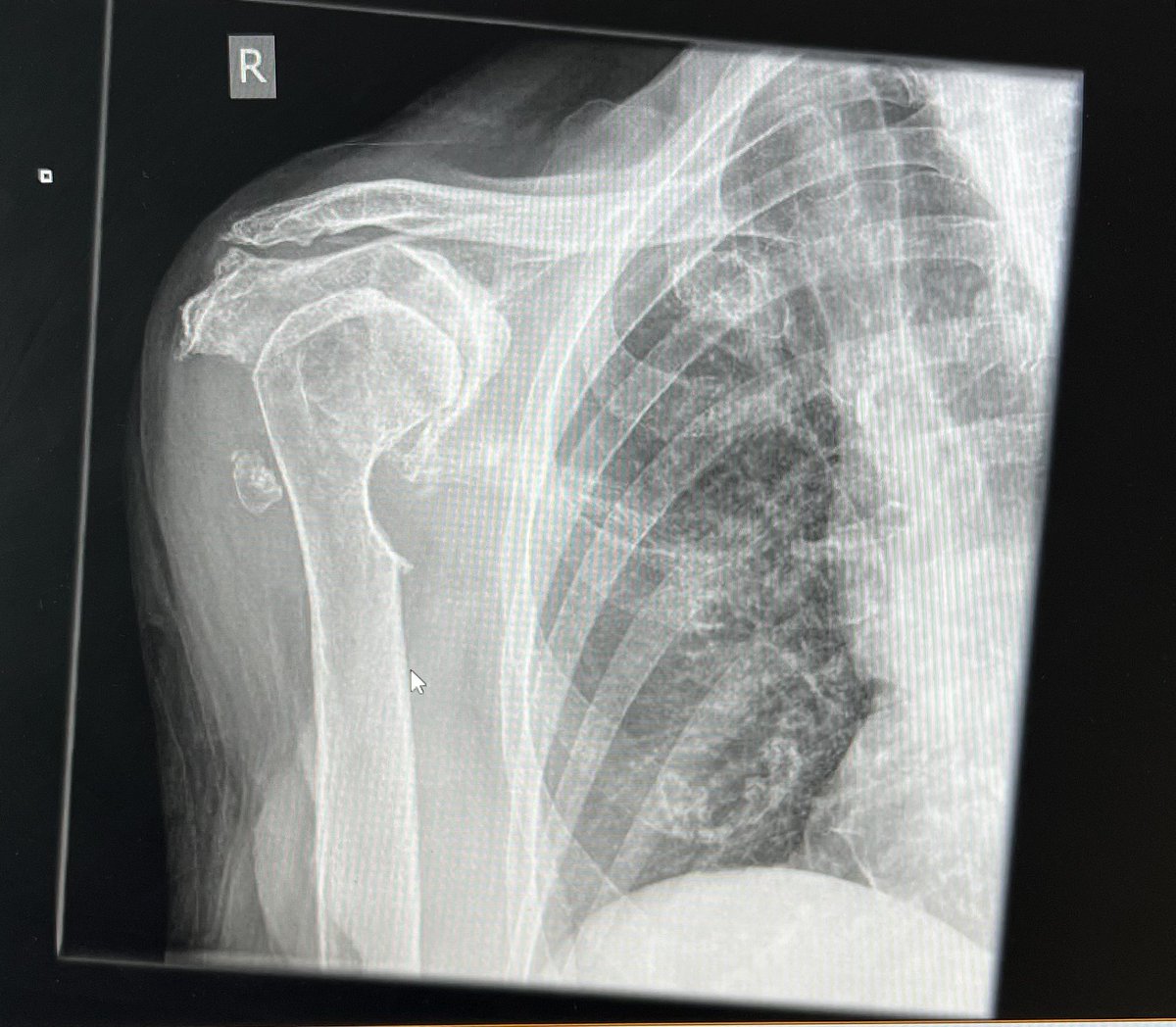 The Sp⚽️rts Physio tweet media