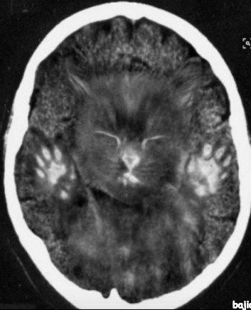 Interesting ct scan.