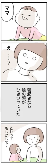 娘が顔面麻痺になった話 2 