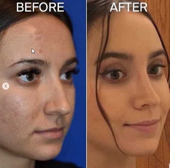 The Portland Center for Facial Plastic Surgery tweet media