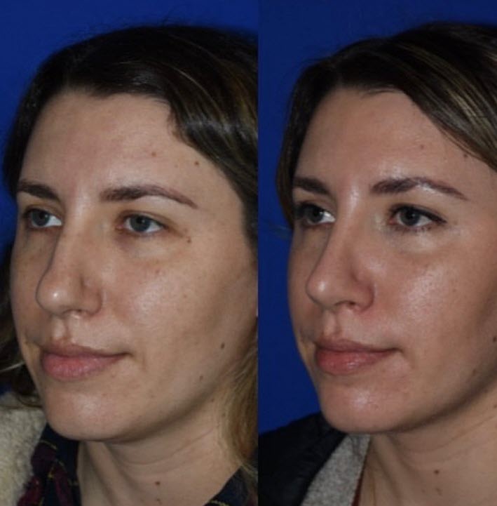 The Portland Center for Facial Plastic Surgery tweet media