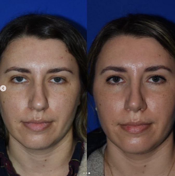 The Portland Center for Facial Plastic Surgery tweet media