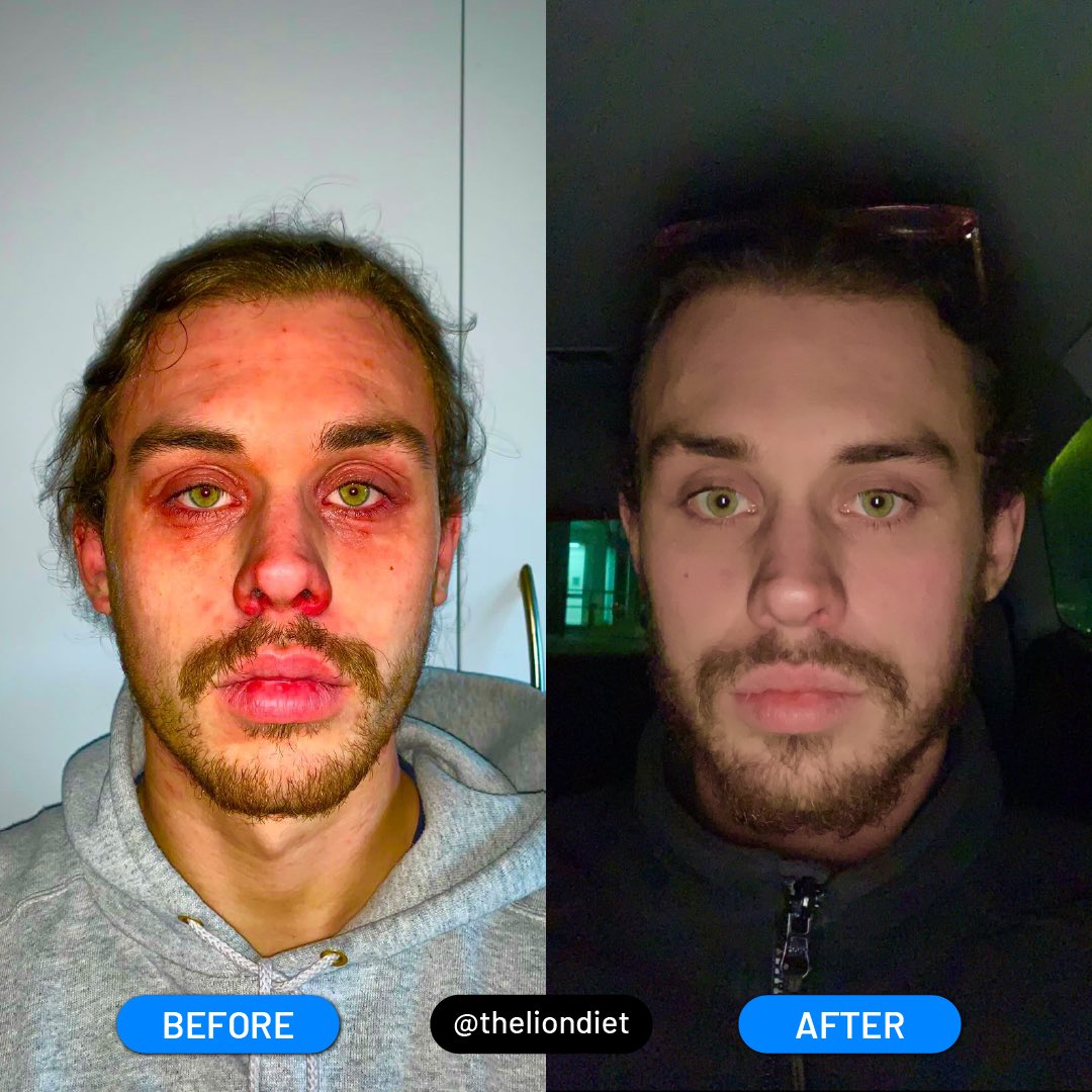 The Lion Diet on Twitter "Jack’s Lion Diet Transformation Age 22