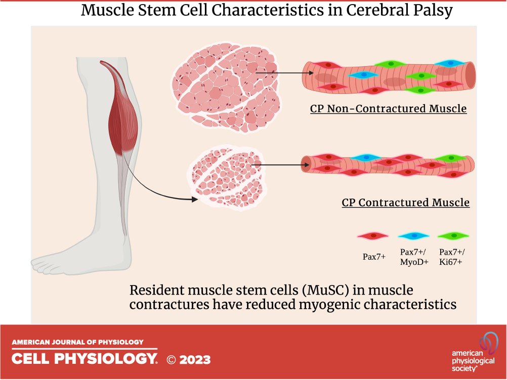 Resident muscle stem cell myogenic characteristics in postnatal muscle growth impairments in children with cerebral palsy (<a href="/RyanKahn12/">Ryan Kahn, PhD</a> <a href="/sududay78/">Sudarshan Dayanidhi</a>  et al.) - new in <a href="/AJPCell/">AJP-Cell Physiology</a> 

ow.ly/Hy8o50MZluP

<a href="/AbilityLab/">Shirley Ryan AbilityLab</a>  <a href="/LurieChildrens/">Lurie Children's</a>  <a href="/NUPTHMS/">Northwestern Physical Therapy</a>  <a href="/aacpdm/">AACPDM</a> 
 
#cerebralpalsy #stemcells