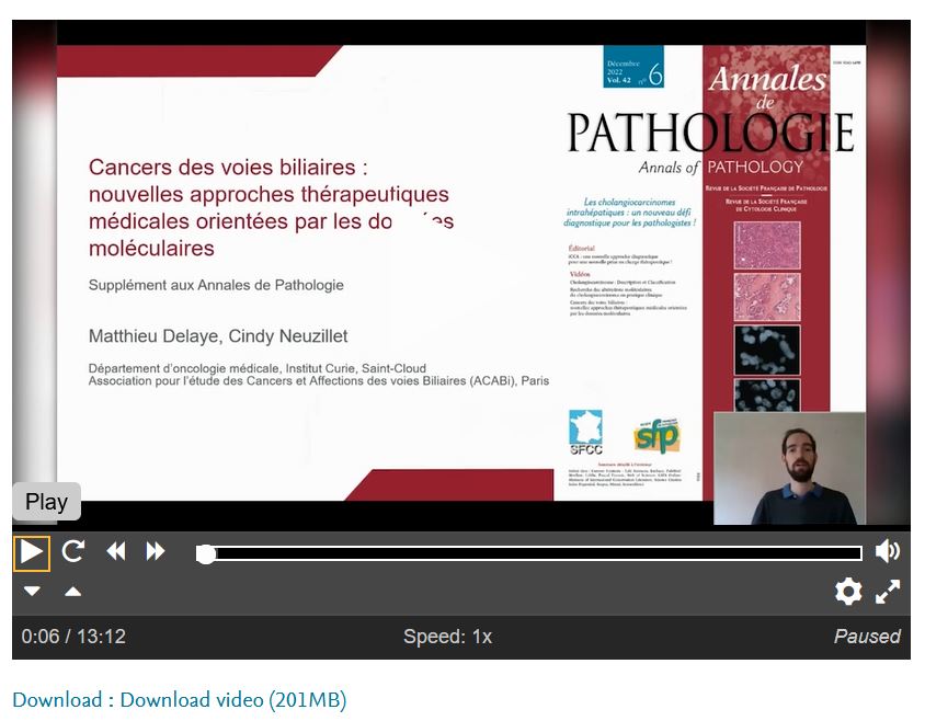Annpathol's tweet photo. 🔬 Le numéro spécial des Annales de Pathologie sur les Cholangiocarcinomes est visionable &amp; téléchargeable gratuitement 
👉 https://t.co/SYjEksdKgg 
🎬 3 vidéos par V.Paradis, J.Selves et M.Delaye/C.Neuzillet
@valerie_paradis  @DelayeMatthieu 
#pathology #gipath #francophonepath https://t.co/iFYyauLuVR