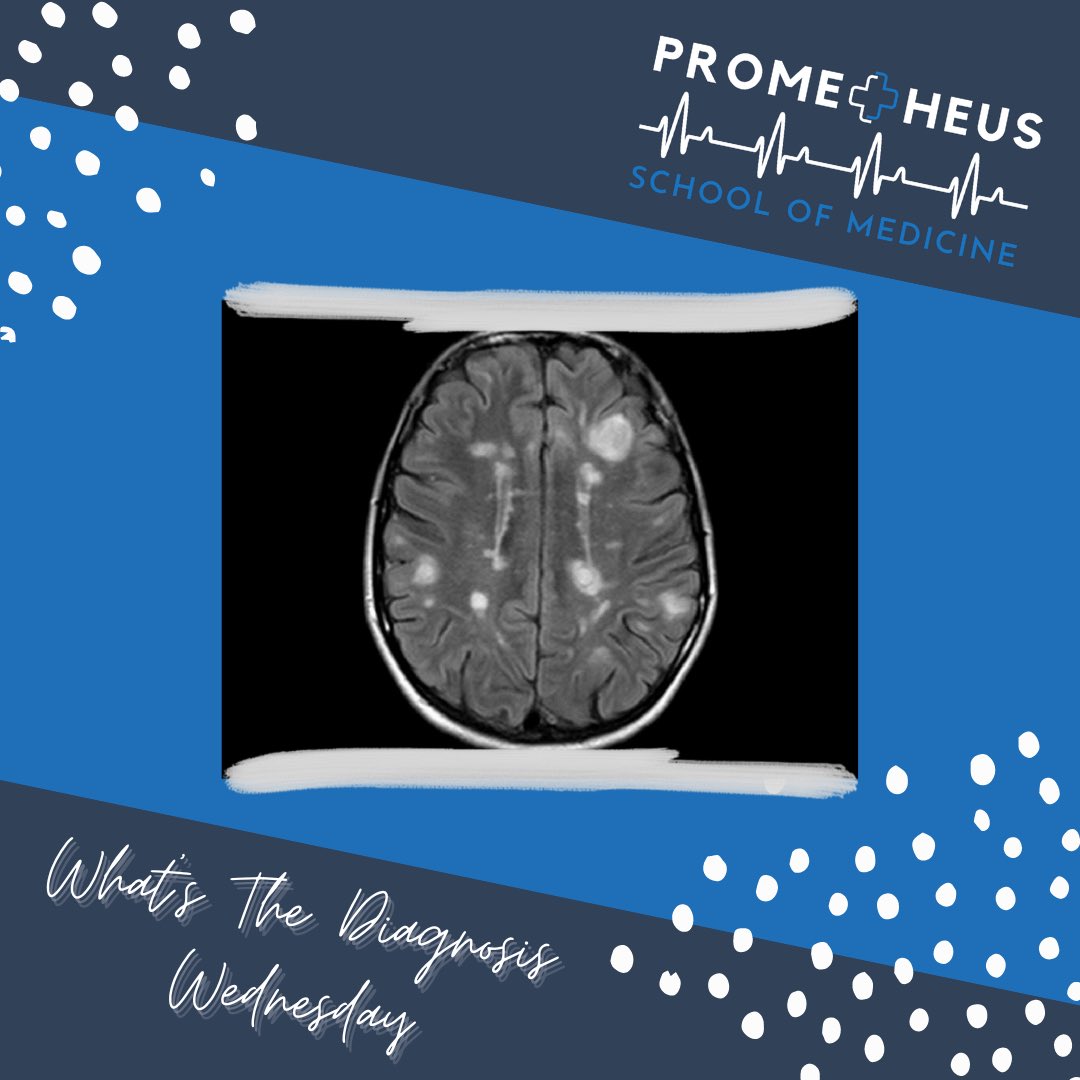 Prometheus_Med's tweet photo. Today is “What’s the Diagnosis Wednesday”! Comment below what you might think the diagnosis is before swiping to see the answer! 
•
•
#medicine #diagnosis #prehealth #wednesday #physician #medicine #doctor #nurse #physicianassistant https://t.co/AfgLjIgEsi