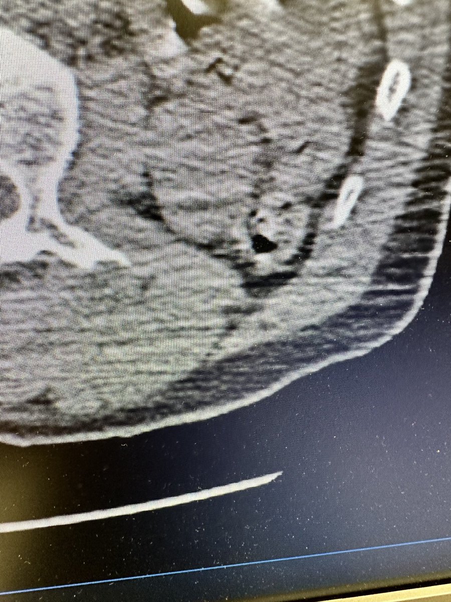 WMolinaKUendouro tweet media