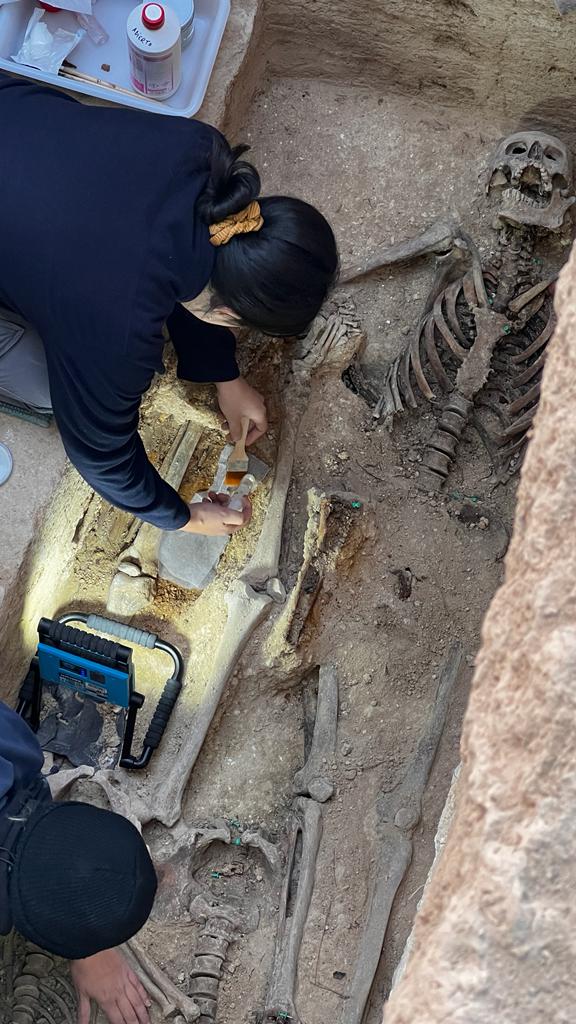OsunaRecuerda's tweet photo. Proceso de consolidación in situ de una férula metálica documentada en la pierna de una de las víctimas. Toda la información suma en @OsunaRecuerda 
@unisevilla https://t.co/UV1Ka27eHn