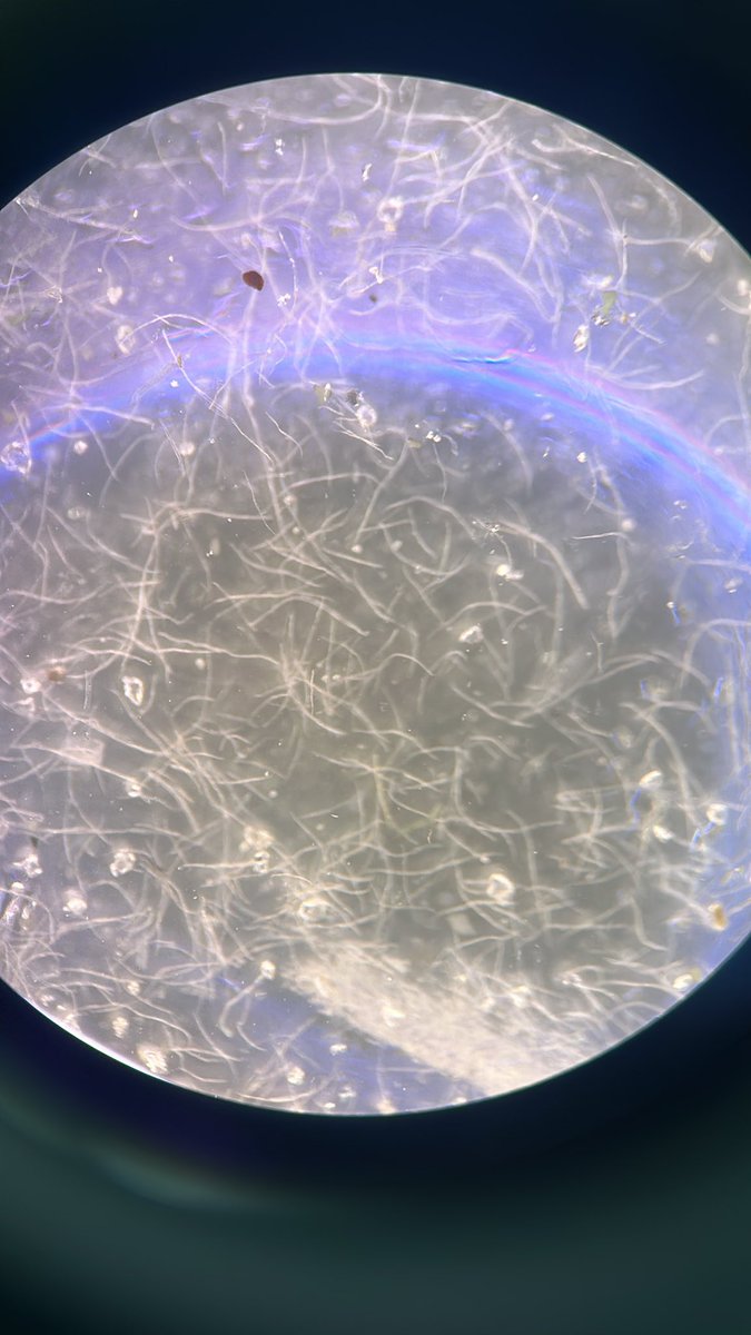 This is one small section of my sample &amp; I’m not convinced my brain can count high enough to quantify these suspected microplastics 😳