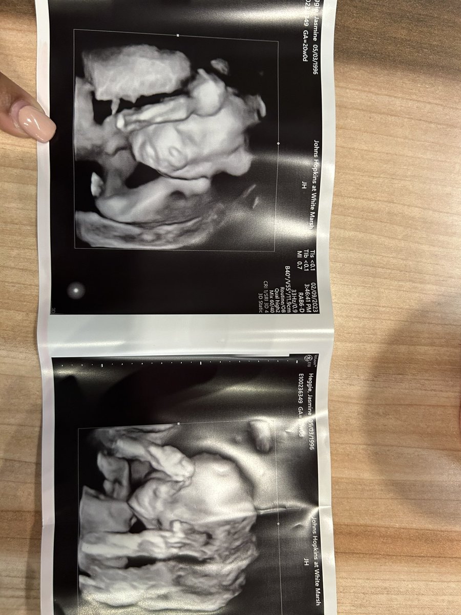 lavishjassss's tweet photo. Entering My 6th Month This Week 🥰 Can’t Wait To Meet My Son 💙🤞🏽🥰 #22Weeks #CAMW💙 https://t.co/2OEhkiOCHX