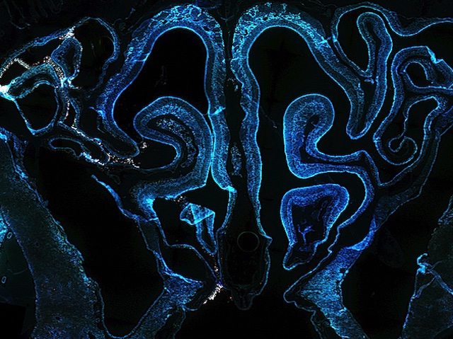 Biomedical Picture of the Day BPoD tweet media