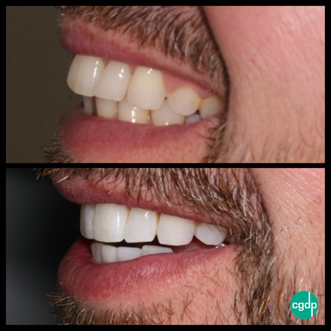 Covent Garden Dental tweet media