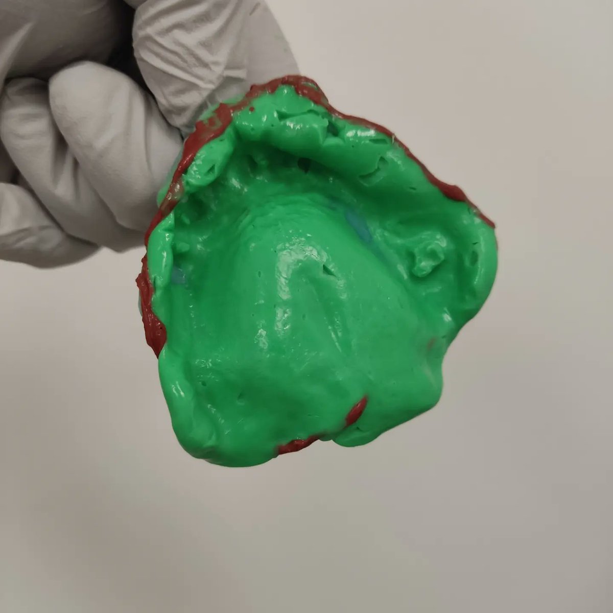 drluisurra's tweet photo. Recuerden Drs., para Pxs desdentados, realizar cucharillas individuales y tomar impresión fisiológica con material ligero y ultraligero.🧑‍⚕️

La retención de nuestras #protesisdentales será excelente 😁

#dentista #odontologia #dientesblancos #dentistry #Irapuato #Guanajuato https://t.co/ecgI4W7RXI