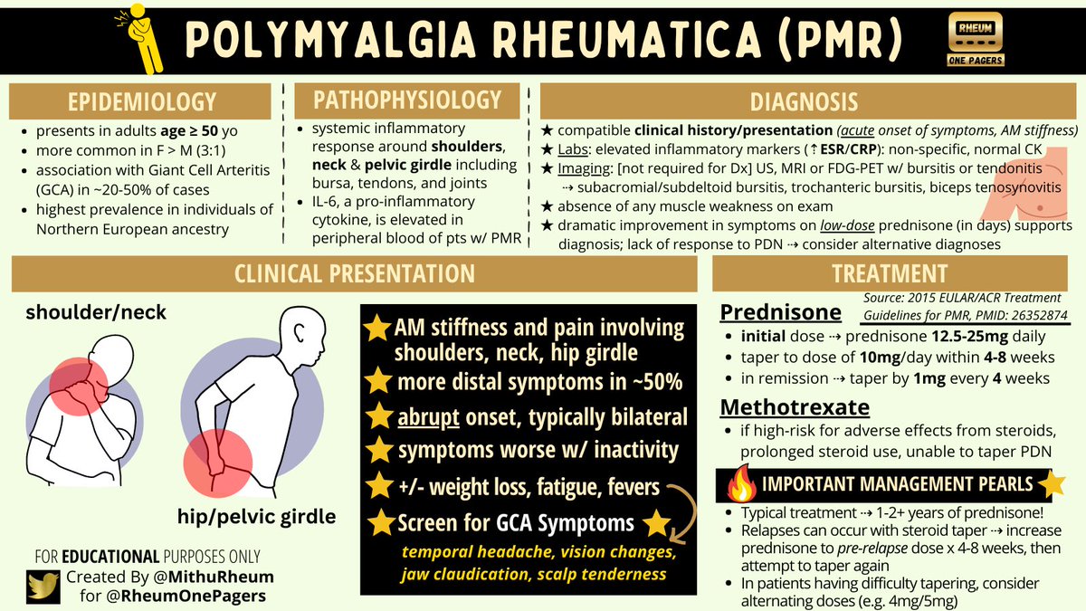 🆕 OnePager: Polymyalgia Rheumatica!

☀️ Abrupt Onset of AM Stiffness in Shoulders/Neck and Hips
💊 Dramatic Response to Low-Dose Prednisone 
🩸 ↑ Inflammatory Markers (ESR/CRP)
📆 Requires Steroids x 1-2 Years to Treat

#MedTwitter #RheumTwitter #MedEd