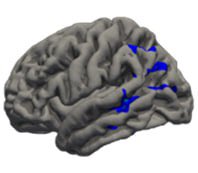 Thrilled to announce I have been awarded an <a href="/alzassociation/">Alzheimer's Association</a> grant for my research on “Using Computational Linguistics for Early Detection of Alzheimer’s Disease”. With this grant, I aim to extract the linguistic biomarkers that detect Alzheimer’s disease at earlier stages
#ENDALZ