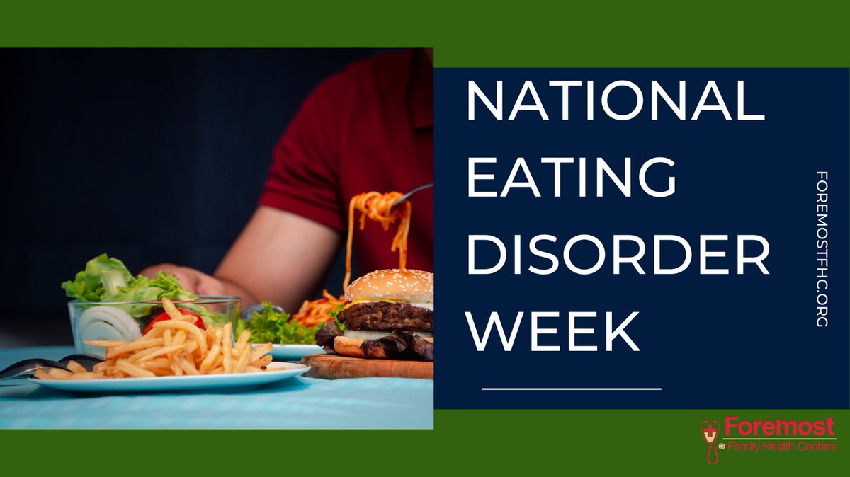 DallasStories's tweet image. Binge #eating disorder (BED) is a severe, life-threatening, and #treatable eating disorder characterized by recurrent episodes of eating large #quantities of food (often very quickly and to the point of discomfort); a feeling of a loss of control during the #binge.