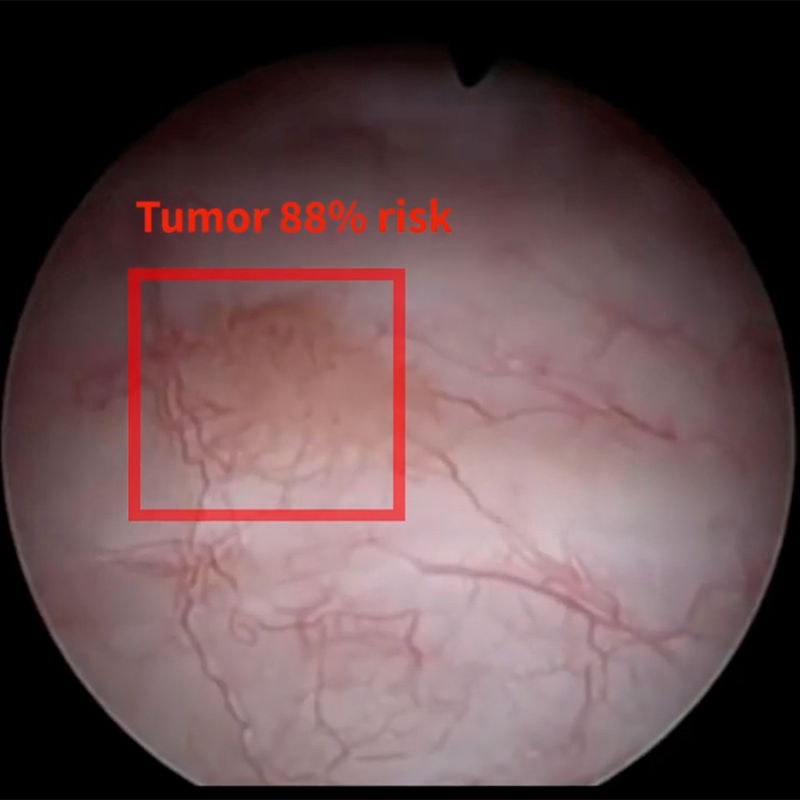 etta_io's tweet photo. Did you know that Etta’s AI technology can be applied to multiple healthcare fields?

Along with assisting dermatology teams, Etta is expanding into urology, with a focus on detecting different forms of bladder cancer during cystoscopy procedures.

Stay tuned for more info! https://t.co/oQRIt0m0vU