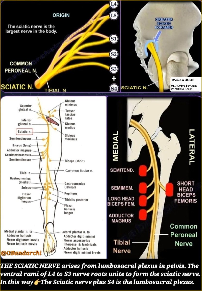 🛑Sciatic nerve(SN) arises from lumbosacral plexus in pelvis.Ventral rami of L4 to S3 nerve roots unite to form sciatic nerve.

👉In this way, the sciatic nerve PLUS S4 is the lumbosacral plexus.
👉In the comment:Anatomical variations of SN course in relation to piriformis muscle