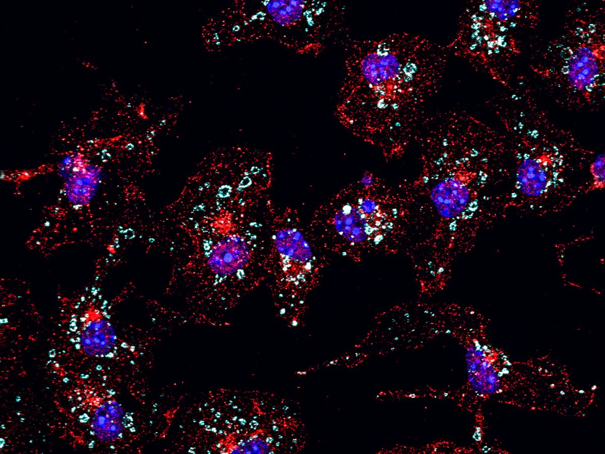 Studying various cell lines, researchers probe the inflammasome #NLRP3 and show how disruptions to #endosomal trafficking can sensitize macrophages to NLRP3 activators, enhancing inflammasome activation and cytokine secretion. <a href="/FBMH_UoM/">UoM Biology, Medicine and Health</a> scim.ag/1En