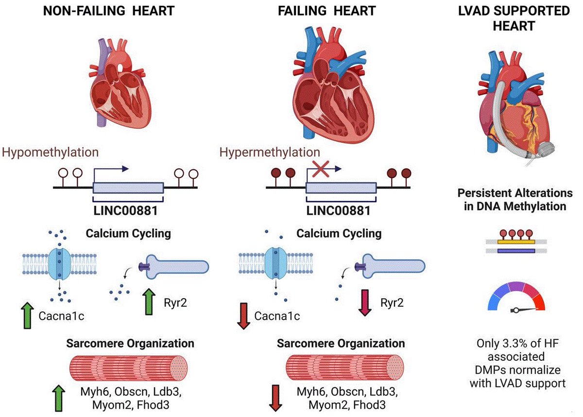 Veli Topkara (@veliktopkaramd) on Twitter photo Excited to share new research from our laboratory led by <a href="/xhliao1/">xhliao</a> and <a href="/peterjkennel/">Peter Kennel</a> on Epigenetics of Heart Failure, Recovery with LVAD, and discovery of LINC00881 as a novel target. Grateful to our collaborators ReillyLab, <a href="/NirUrielMD/">Nir Uriel, MD MSc</a>, @GVNLab, <a href="/SMarxLab/">Steven Marx</a>.
insight.jci.org/articles/view/… Excited to share new research from our laboratory led by <a href="/xhliao1/">xhliao</a> and <a href="/peterjkennel/">Peter Kennel</a> on Epigenetics of Heart Failure, Recovery with LVAD, and discovery of LINC00881 as a novel target. Grateful to our collaborators ReillyLab, <a href="/NirUrielMD/">Nir Uriel, MD MSc</a>, @GVNLab, <a href="/SMarxLab/">Steven Marx</a>.
insight.jci.org/articles/view/…