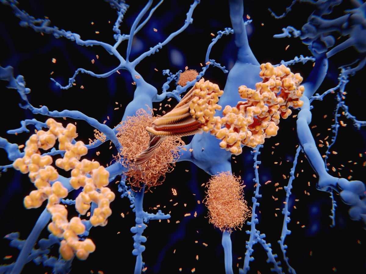 Mouse model studies and #RNAsequencing enable @UCSF  to uncover evidence indicating ApoE4 removal as a potential treatment strategy for #Alzheimersdisease. Learn more: ow.ly/oF9s50MZj26