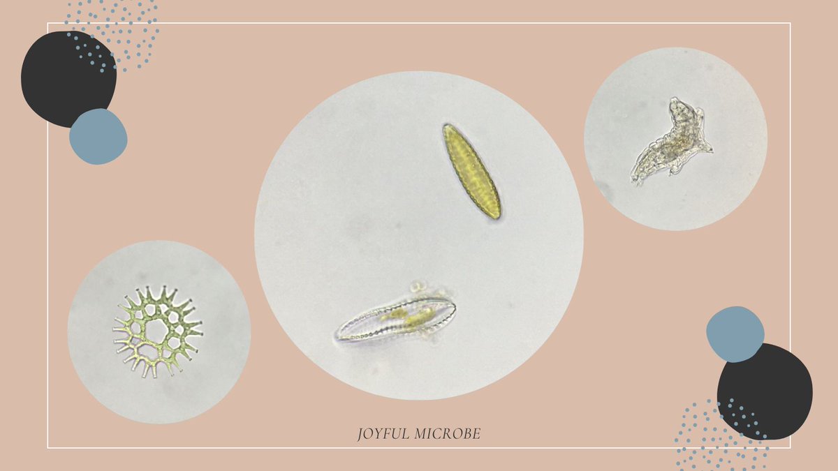 joyfulmicrobe's tweet image. Looking under the microscope is like opening a portal to a whole new world! The things you can see are simply mind-blowing 🤯 #ScienceIsAwesome #Microscopy