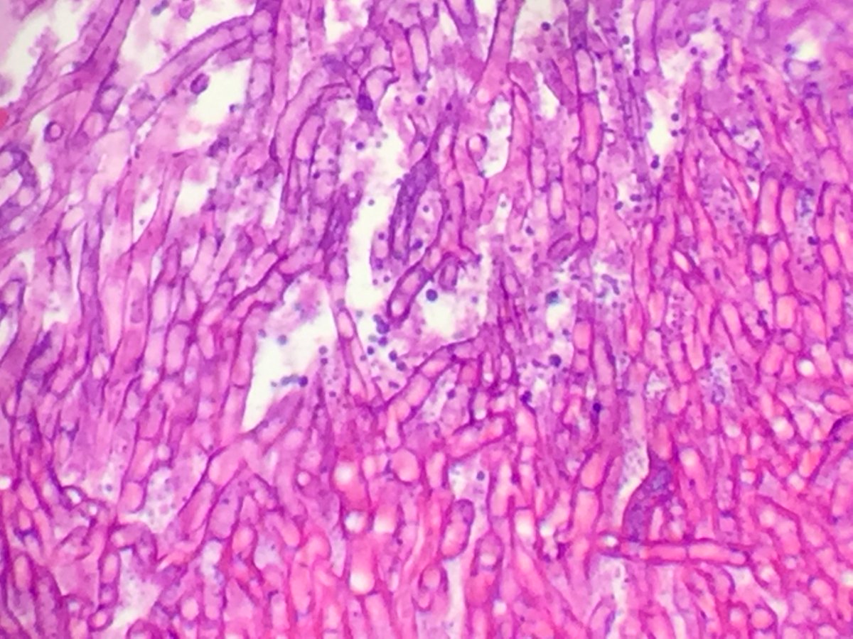 cuimc_id's tweet photo. Exciting opportunity for Medical Microbiology training starting 7.1.23! You will work with amazing colleagues &amp; mentors in Pathology and ID @cumc_ID. Open to ID fellows and junior faculty!
https://t.co/bGkM8fDXNI https://t.co/MiXE7nDXYX
