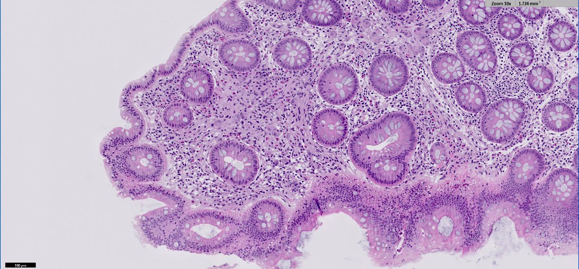 #Pathnewbies #Pathresidents 

What do you 👀?

#PathTwitter #GIPath
