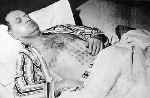 1967: The #Encounter at Falcon Lake
Stephen Michalak prospecting near Falcon Lake, #Manitoba, encountered 2 #UFOs, 1 landed on a large, flat rock 160 ft away. He approached, looked inside, and something like an exhaust vent blasted hot gas shot from these holes onto his chest.