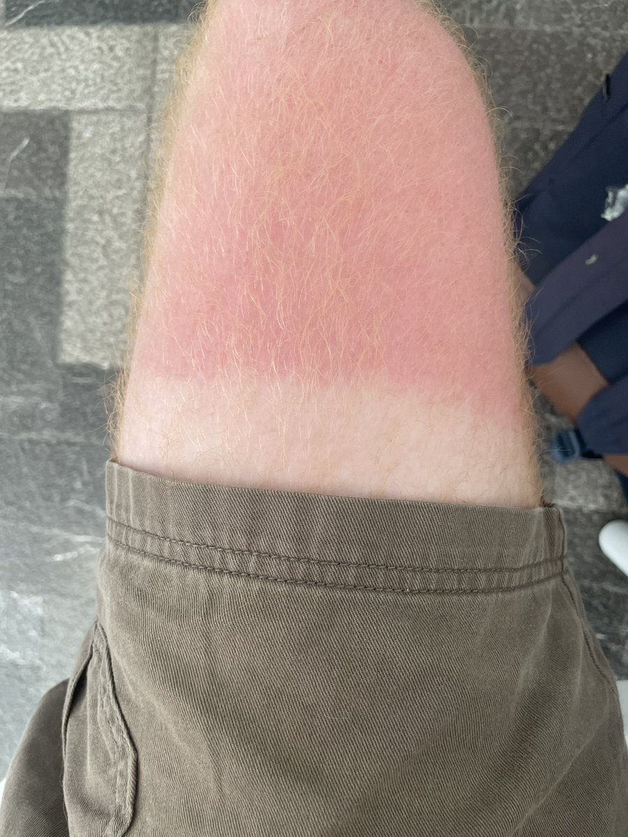 material406swap's tweet photo. Setting a nice base tan https://t.co/D1mE3e7FAB