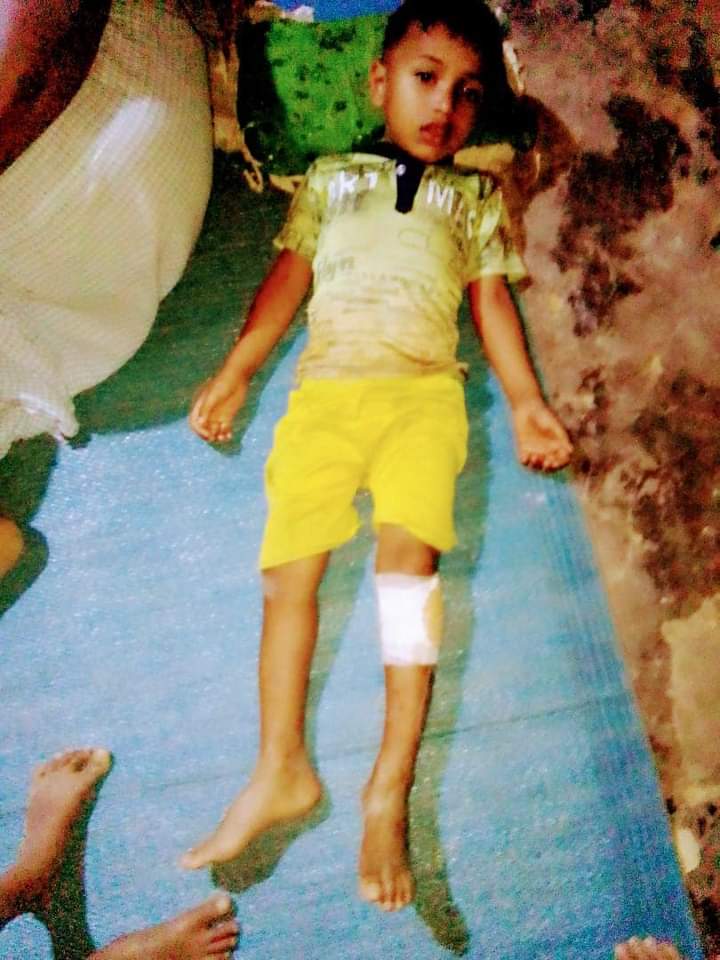 RHR_Asem's tweet photo. Rohingya Refugee Camp No. 5 in Kontbazar District. Bangladesh According to sources in the refugee camp, fighting between two armed groups has continued since this evening in Rohingya Refugee Camp No. 5 in Kontbazar District. https://t.co/JgVsxCbADR