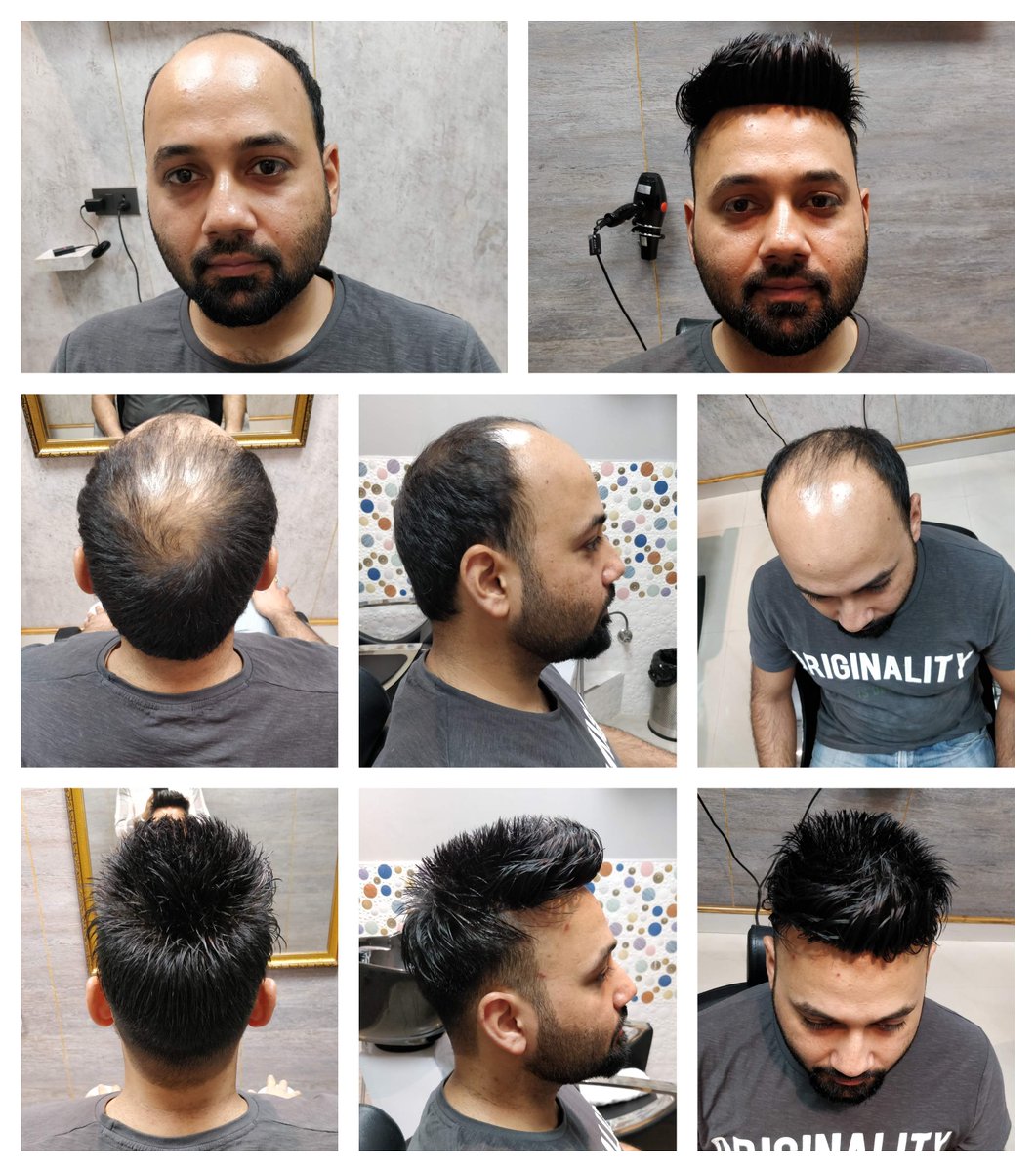 Prem Hair Expert (@HairLynx) / Twitter Prem Hair Expert (@HairLynx) / Twitter