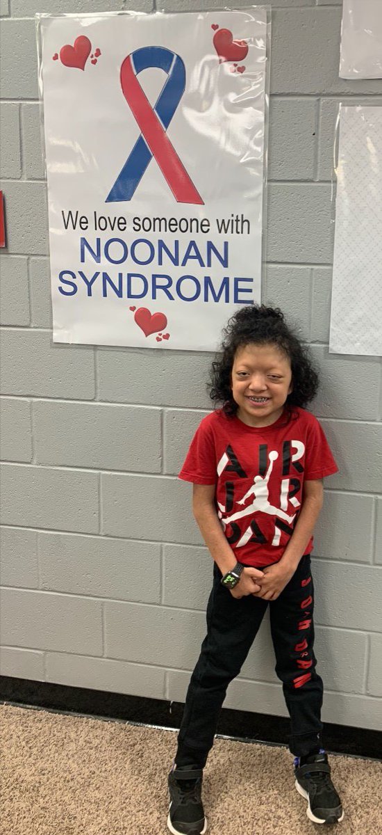 ChhsMightyStang's tweet photo. ❤️💙Today is Noonan Syndrome Awareness Day! Today we remember our sweet Gabbi and all warriors!! #NoonanSyndromeAwarenessMonth
#CongenitalHeartDefectAwareness
#HeartDiseaseMonth #ForGabbi😇❤💙 @TweetDCS_CHHS @DCSeNews https://t.co/2F0ENT1g2L