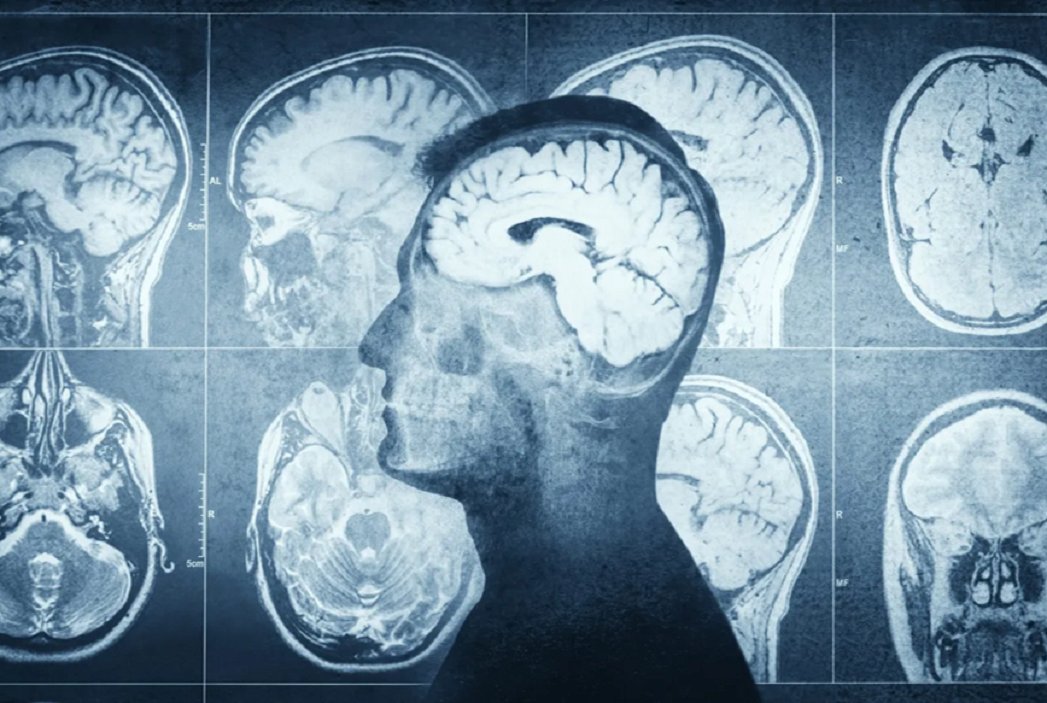 ICFOnians's tweet photo. Neix el projecte #SafeICP per crear un monitor intel·ligent que mesuri la pressió intracranial de manera no invasiva
El projecte està liderat per l’@ICFOnians amb la participació de @DTIC_UPF, la #ICFOSpinOff ProCareLight i el @VHIR_
👉https://t.co/QCyLUyNChF https://t.co/wLItYiz61I
