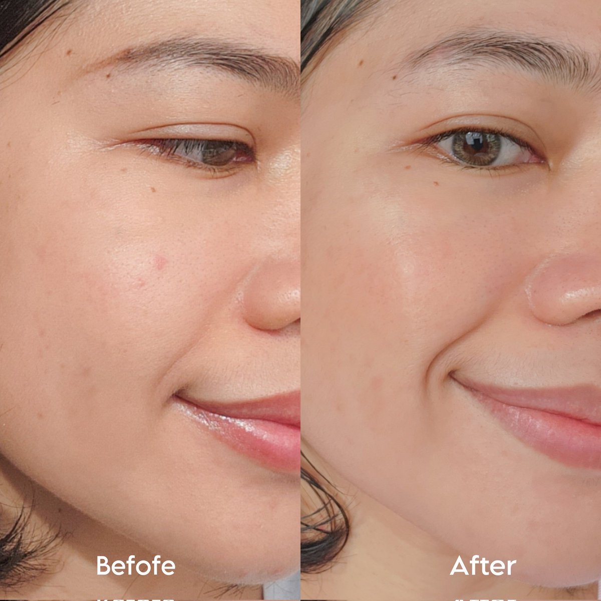 ChaliReviews's tweet image. ป้ายยาหนึ่งในวิตมินเสริมที่กินอยู่แล้วชอบมากกก #Lactium Complex วิตามินผิวสวย✨️ จากน้ำนมหยดแรก ตัวช่วยบูทส์ผิวใส ทานวันละ 2 แคปซูล หลังทานผิวละเอียดขึ้น พวกรอยสิวดีขึ้นมากๆ เลิฟมาก ❤️ ต้องไปตำ #ใช้ดีบอกต่อ