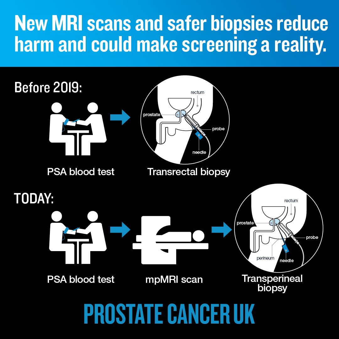 ProstateUK's tweet image. 🧵 We could be one step closer to a UK screening programme for prostate cancer. 

Organised screening could cut deaths by 20%, but until recently the drawbacks outweighed the benefits.

Our research has led to new scans and safer biopsies, meaning 67% fewer men experience harm.