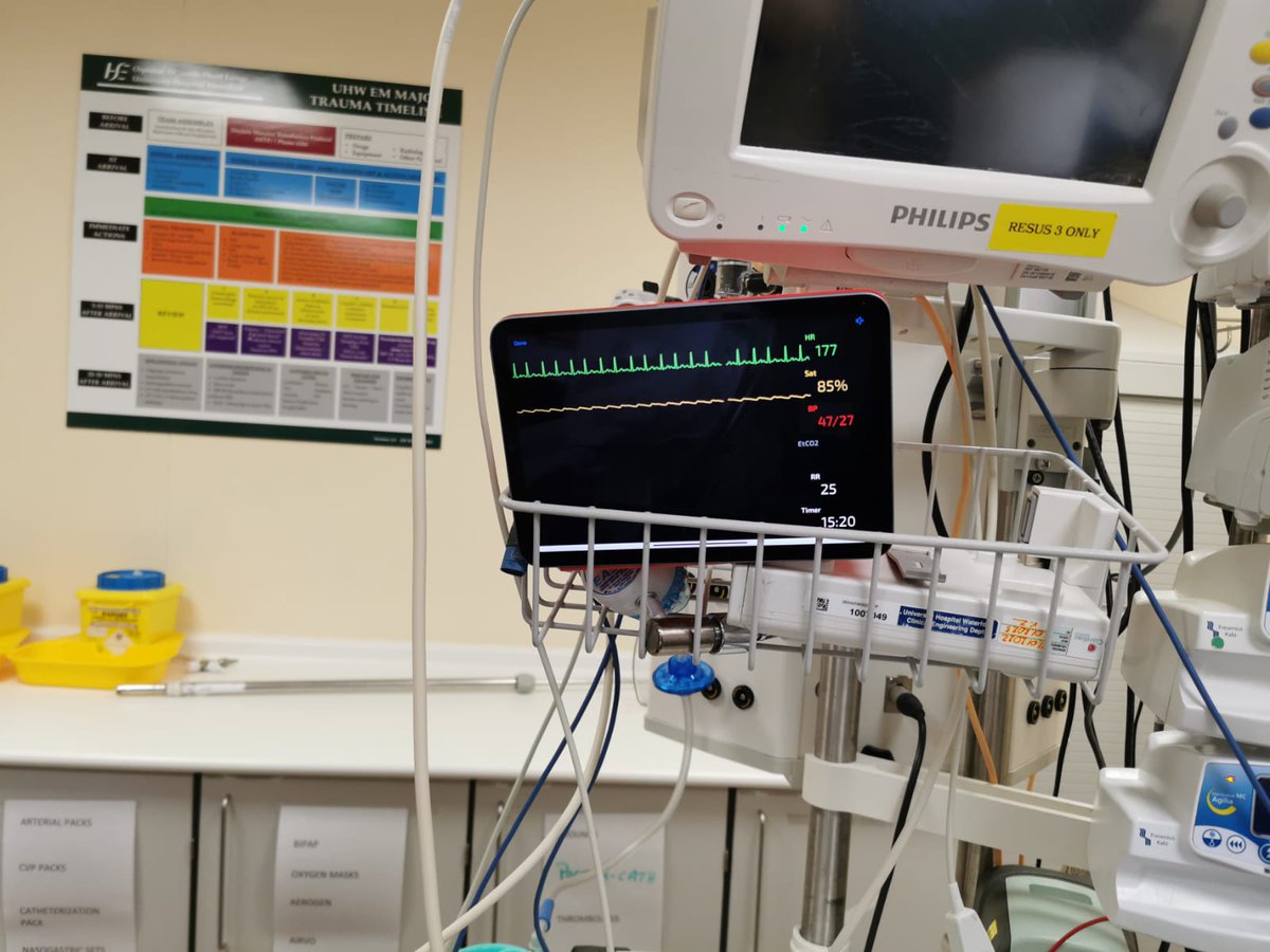 A 'piercingly' good simulation in ED @UHW_Waterford with some hidden stab wounds in this major trauma sim. Discussion after on 'stab check', MTP, and tube thoracostomies!