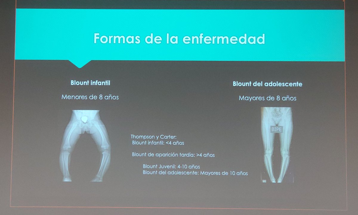 Cot_clinico_VLC's tweet photo. El Dr Antonio Darder expone la revisión y experiencia del Servicio @Cot_clinico_VLC sobre la
🔹Enfermedad de #Blount
Sesiones de formación COT del @GVAclinic , en las instalaciones del @incliva_iis https://t.co/gRM4l4jpja