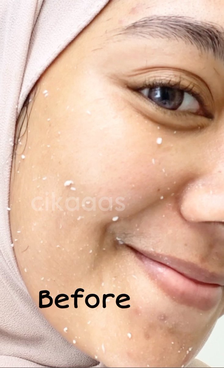 cikaaas's tweet photo. @senjatanuklir Seharian ini aku kerja pulangpergi naik kereta yg pasti bikin muka aku kotor &amp; dakian, dan malam jumat ini waktunya buat ehem ehem sama suami, jd sebelum memulai ritual malem jumat,aku pake licorice peeling gel nya @NPUREOFFICIAL biar muka aku bebas daki dan suami makin cinta🤭😍 https://t.co/IsBT26dd8U