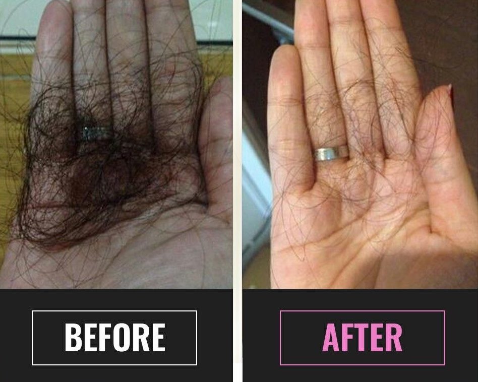 ezzahnor's tweet photo. Top 10 most effective shampoo for hair fall for you to try.

-A thread https://t.co/yBNAZt04lV