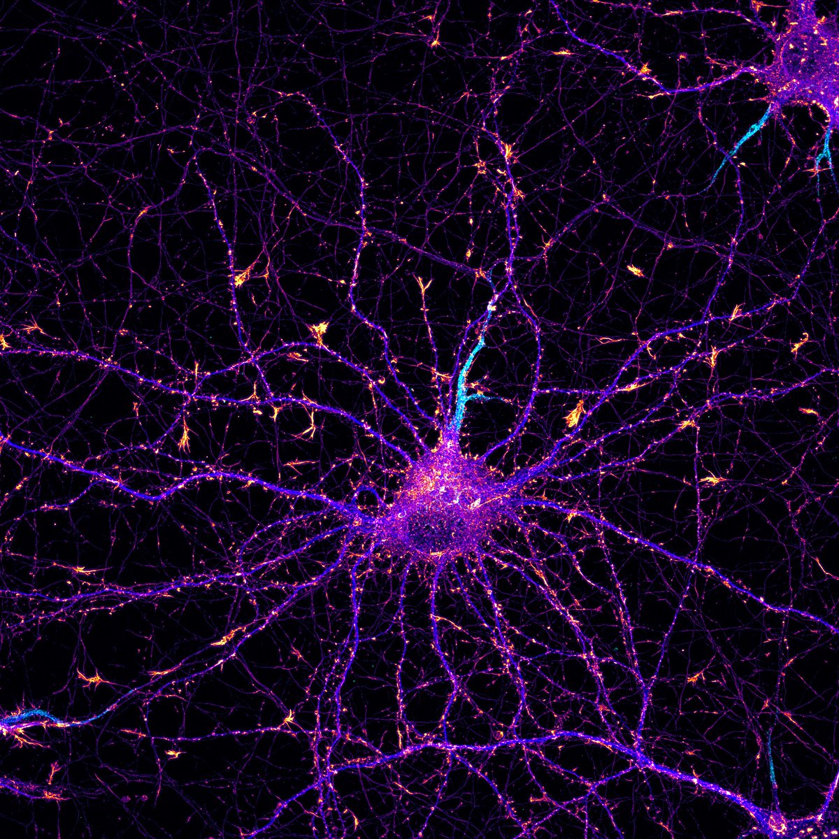 A neuron on fire! #cellfie #ThrowbackThursday