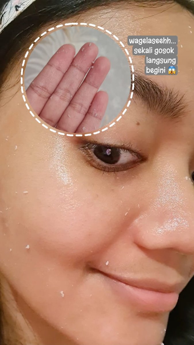 pritandriyana's tweet photo. @senjatanuklir NPURE Licorice Peeling Gel..
Sekali gosok langsung keangkat semua sel kulit mati, pori-pori jadi bersih dan peelingnya gak perih sama sekali..
Setelah dibilas kulit langsung kinclong dong ✨❤️✨
Malam jumat bebas daki,,
Muka auto glowing, cerah, bersinar sunny.. ✨✨ https://t.co/xlKbai2qqQ