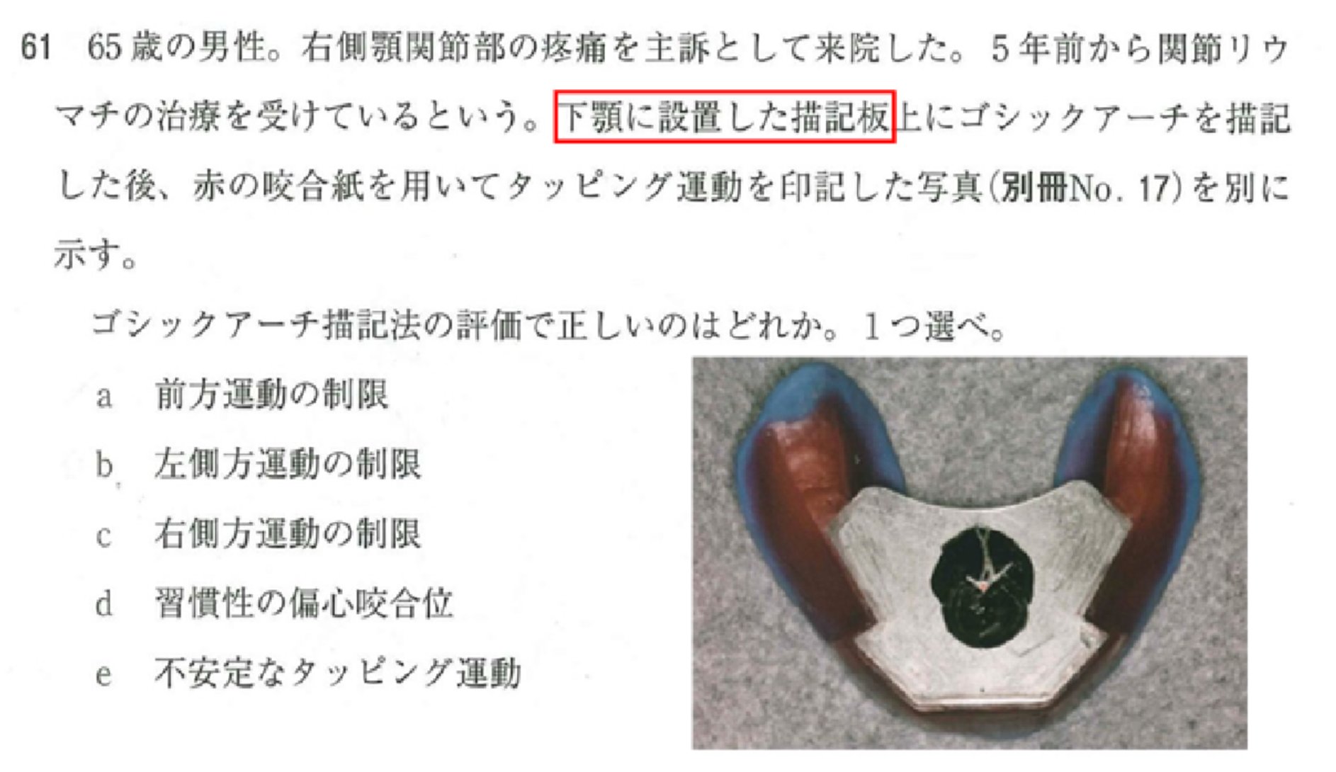 歯科医師国家試験対策 ロムニーハウス