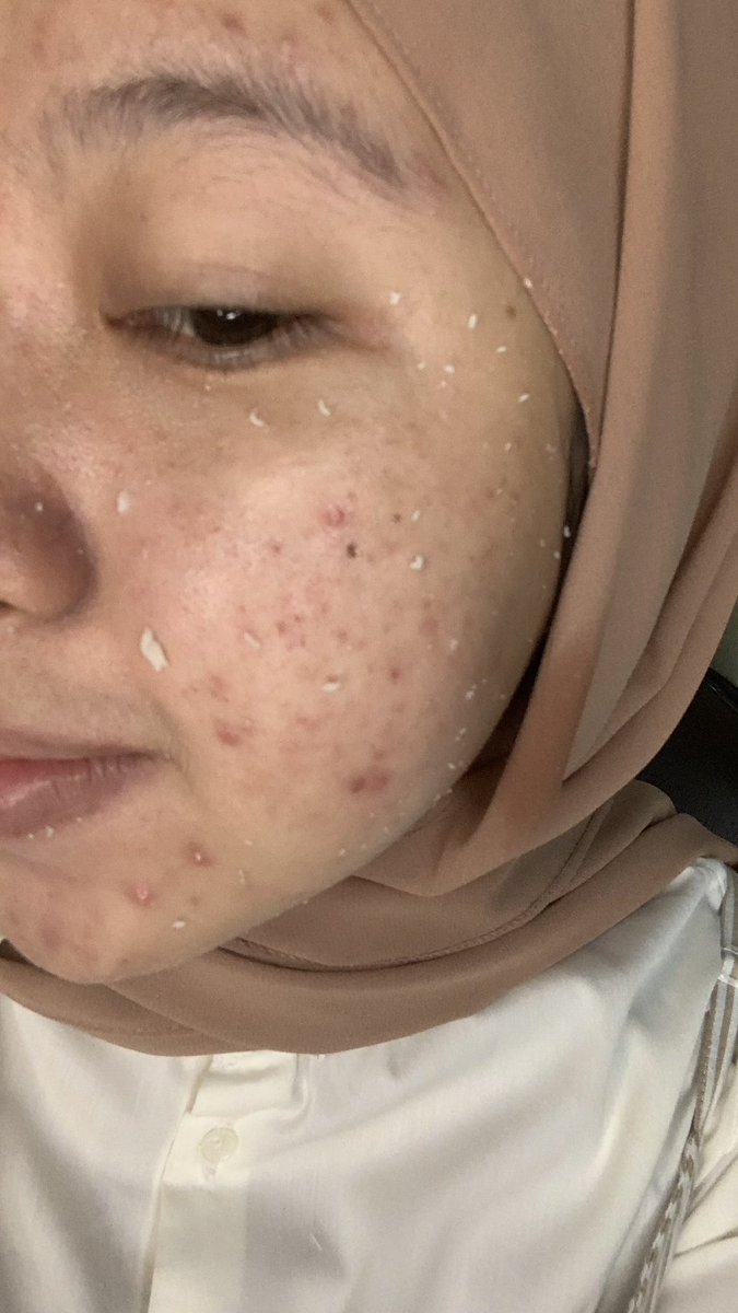 Rinny Puspa tweet media