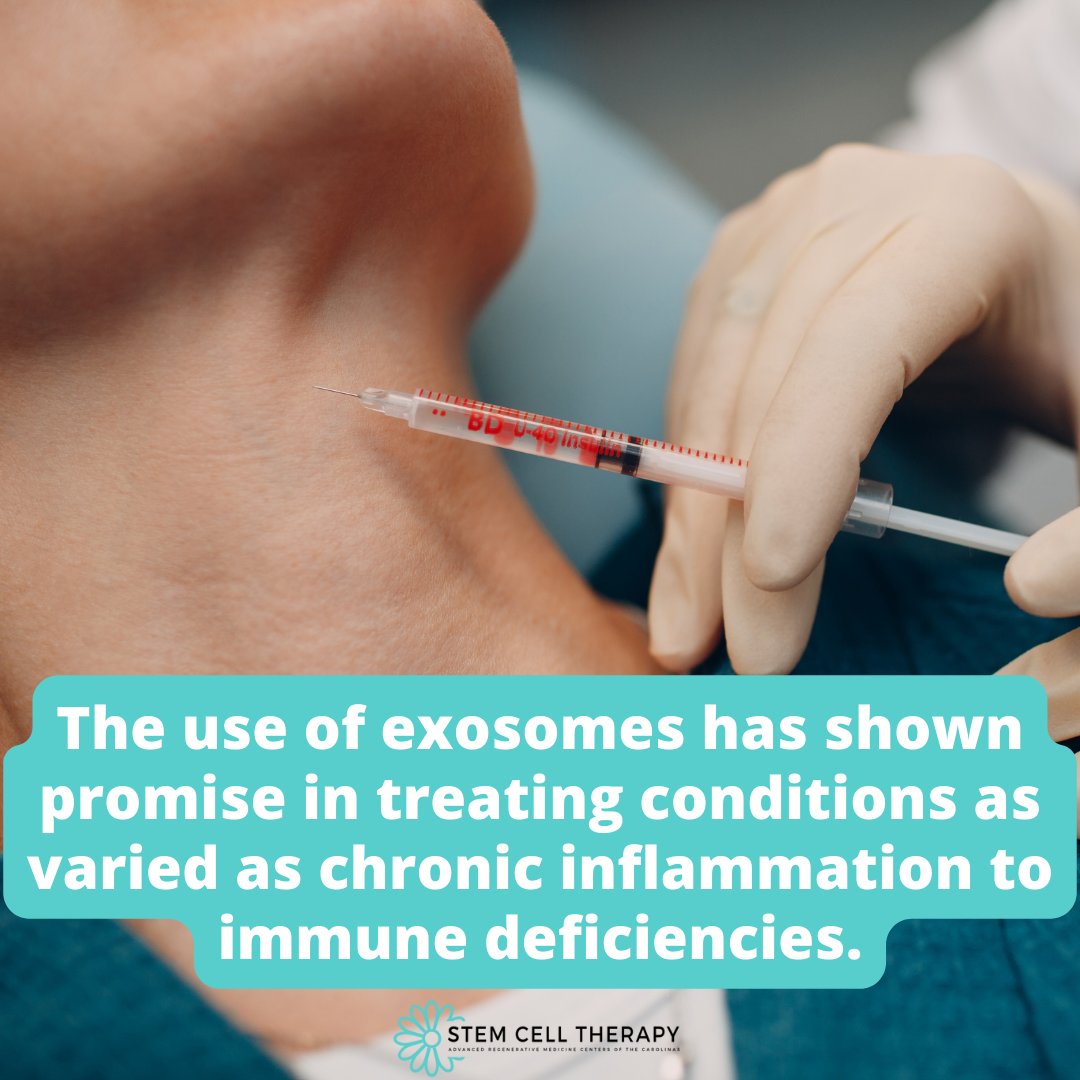 Benefits of exosome therapy:
- Joint repair
- Heals tissue damage
- Hair restoration
- Skin rejuvenation 
- Wrinkle reduction

Learn more ➡️ bit.ly/3XE7ABh 

#stemcelltherapy #exosometherapy