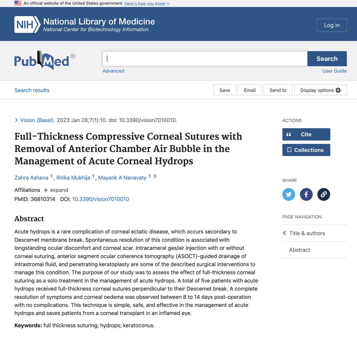 Our technique to deal with acute hydrops in keratoconus can be found at lnkd.in/eGz96pi9. Thanks to Zahra Ashena and <a href="/dr_ritika_eye/">Ritika Mukhija</a>. #keratoconus; #emergencycare; <a href="/UKISCRS/">UKISCRS</a>: <a href="/RCOphth/">Royal College of Ophthalmologists</a>; <a href="/ESCRSofficial/">ESCRS</a>; <a href="/ASCRStweets/">ASCRS</a>; <a href="/aao_ophth/">American Academy of Ophthalmology</a>; <a href="/EuCornea/">EuCornea</a>