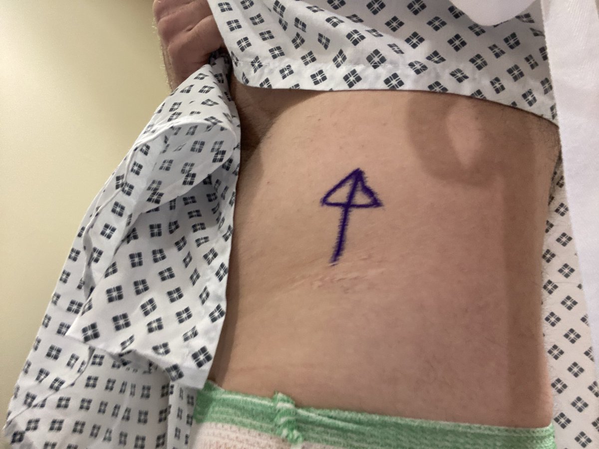 John_Tollitt's tweet photo. 2 years ago today.
#kidneycancer #radicalnephrectomy https://t.co/ETSTT9otlF