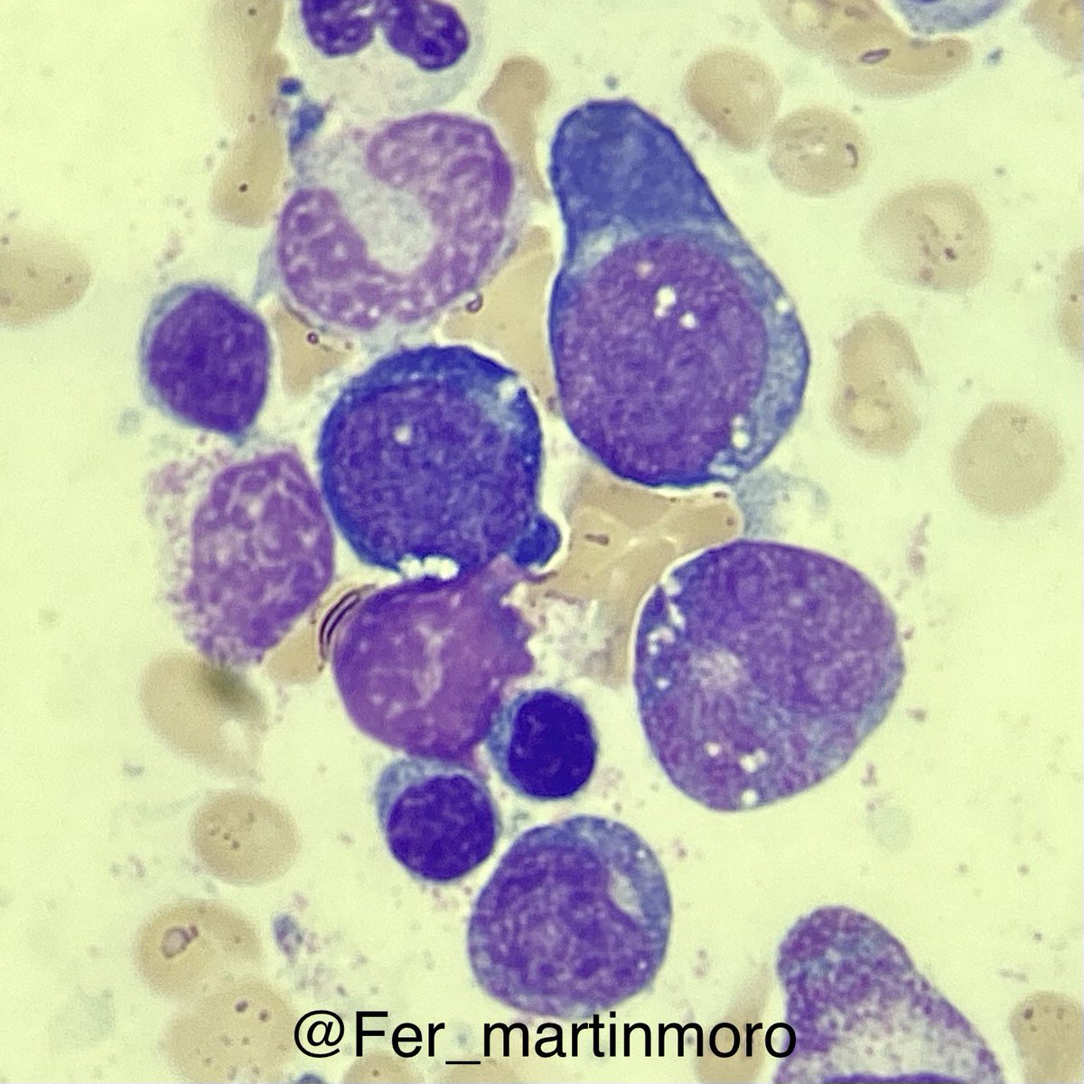 Fernando Martín Moro tweet media