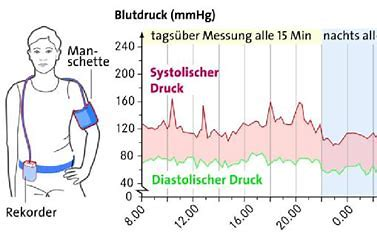 WaldaHood's tweet photo. Langzeitblutdruckmessung in 2023. Für jeden Scheiß' gibt's eine App und die halbe Welt trägt Fitnessuhr. Das Kabel ist doppelt so lang wie nötig und alles rutscht. Voll genervt, auf die Werte bin ich gespannt und damit soll ich schlafen. #gesternisterstübermorgen #runningsystem https://t.co/WMFGm3NtHx