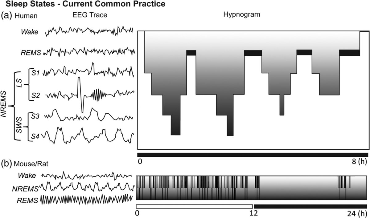 Genzel_Lab (@genzellab) on Twitter photo Review alert! A new review from the lab and the first contribution of <a href="/Abdelrayan2/">Abdel.rayan</a> with Genzel lab. We provide a comprehensive overview on automatic sleep scoring in rodents, focusing on rats. Furthermore, we raise several concerns related to rodentsβ sleep scoring in general Review alert! A new review from the lab and the first contribution of <a href="/Abdelrayan2/">Abdel.rayan</a> with Genzel lab. We provide a comprehensive overview on automatic sleep scoring in rodents, focusing on rats. Furthermore, we raise several concerns related to rodentsβ sleep scoring in general